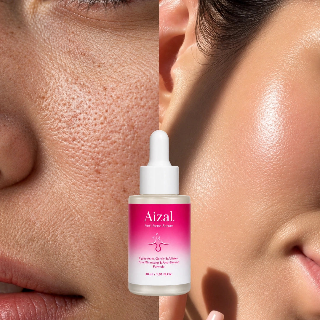 Anti Acne Serum 30ml | Clear & Healthy-Looking Skin